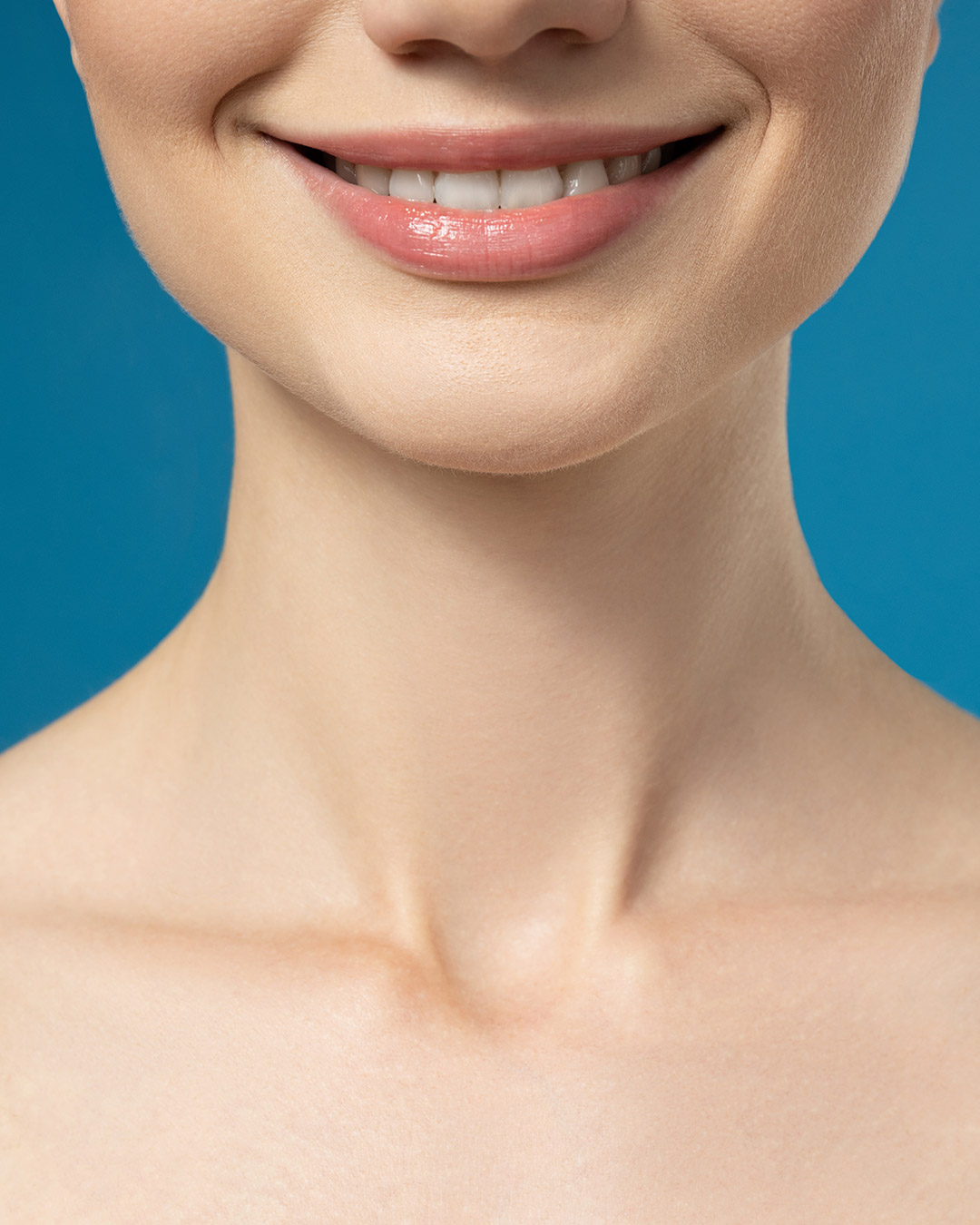 Résultat esthétique après une génioplastie en Tunisie avec Trivamed : menton redessiné et visage équilibré.