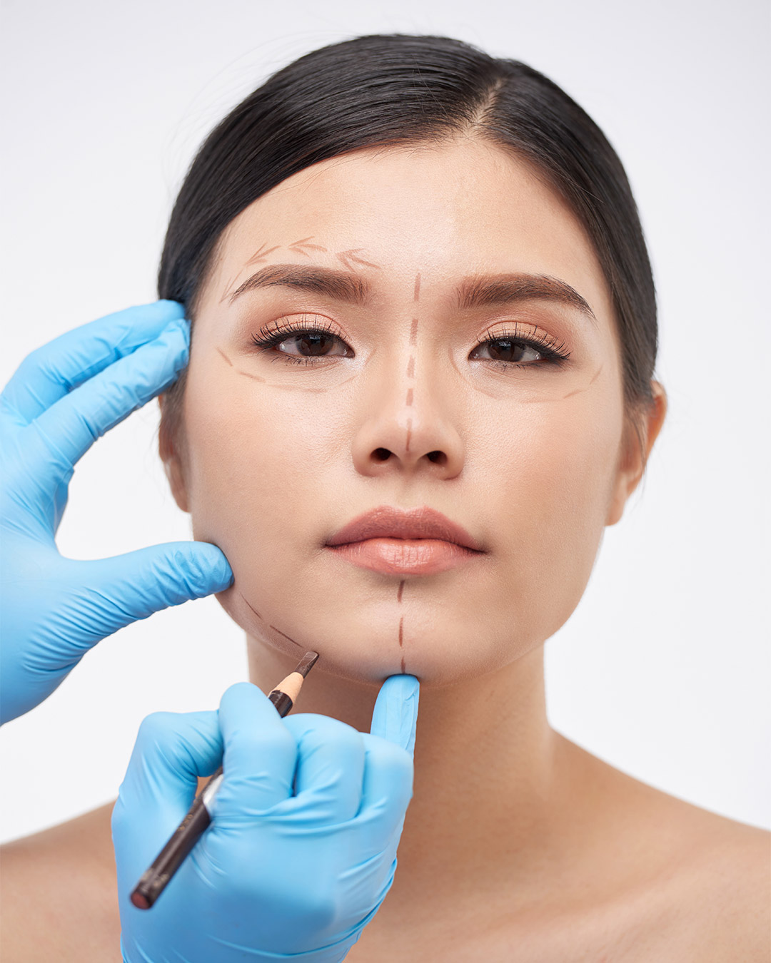 Génioplastie en Tunisie avec Trivamed – chirurgie du menton pour corriger un menton fuyant ou asymétrique.