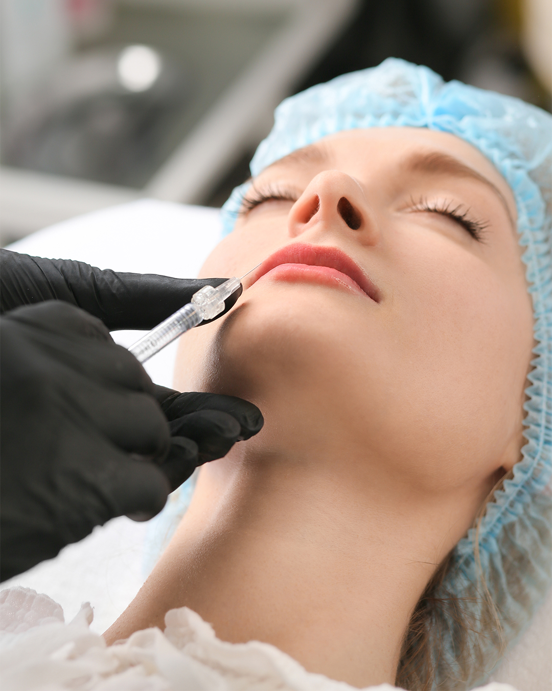 Lipofilling du visage en Tunisie avec Trivamed – transfert de graisse pour restaurer les volumes naturellement.