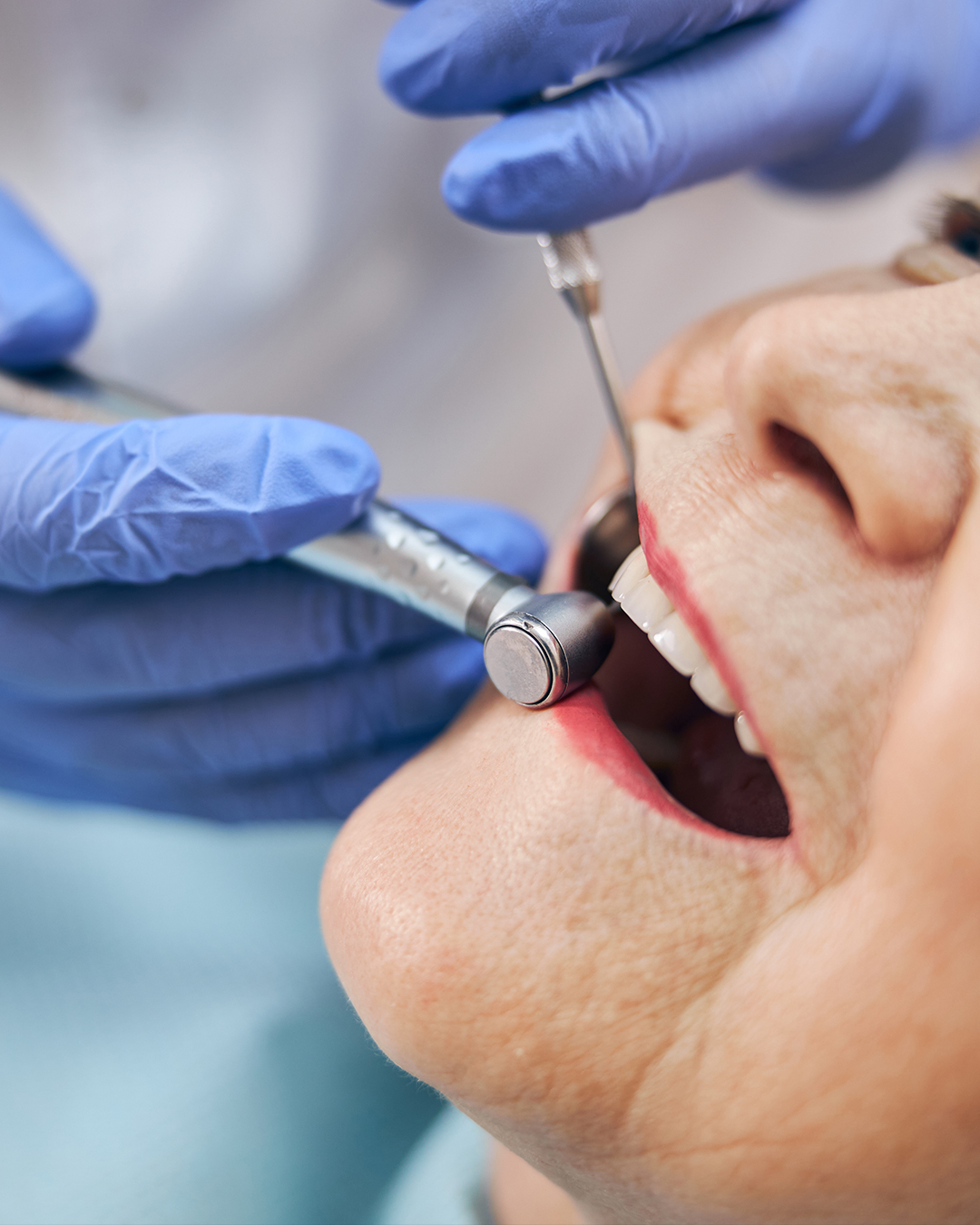 Avantages de l’implantologie dentaire en Tunisie avec Trivamed : dents naturelles, confort, stabilité, durabilité et qualité de vie améliorée