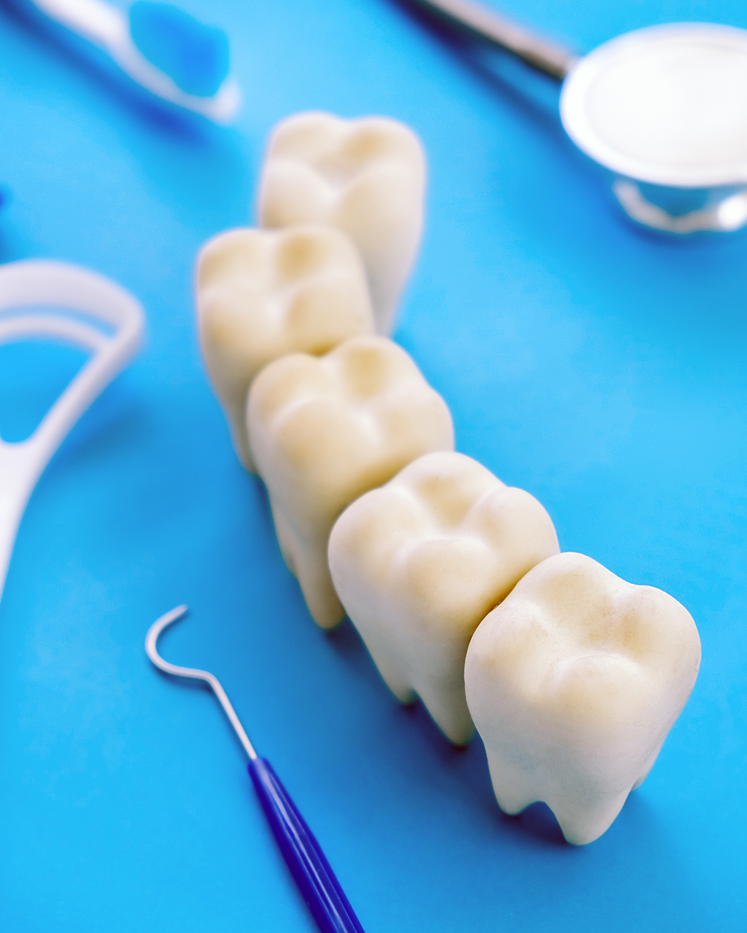 Bridges dentaires en céramique zircone en Tunisie avec Trivamed pour remplacer les dents manquantes avec durabilité et esthétique