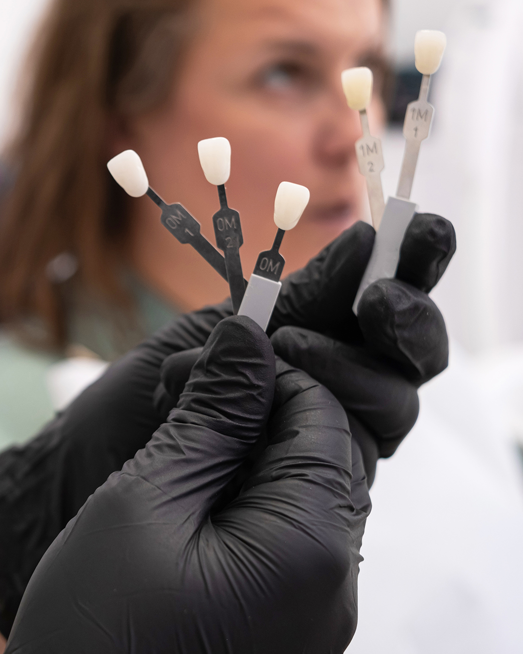 Facettes dentaires en Tunisie avec Trivamed pour améliorer la couleur, la forme et l’alignement des dents