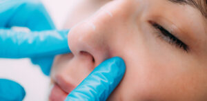 Rhinoplastie en Tunisie