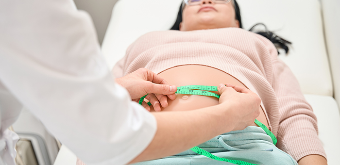 Sleeve gastrique en Tunisie