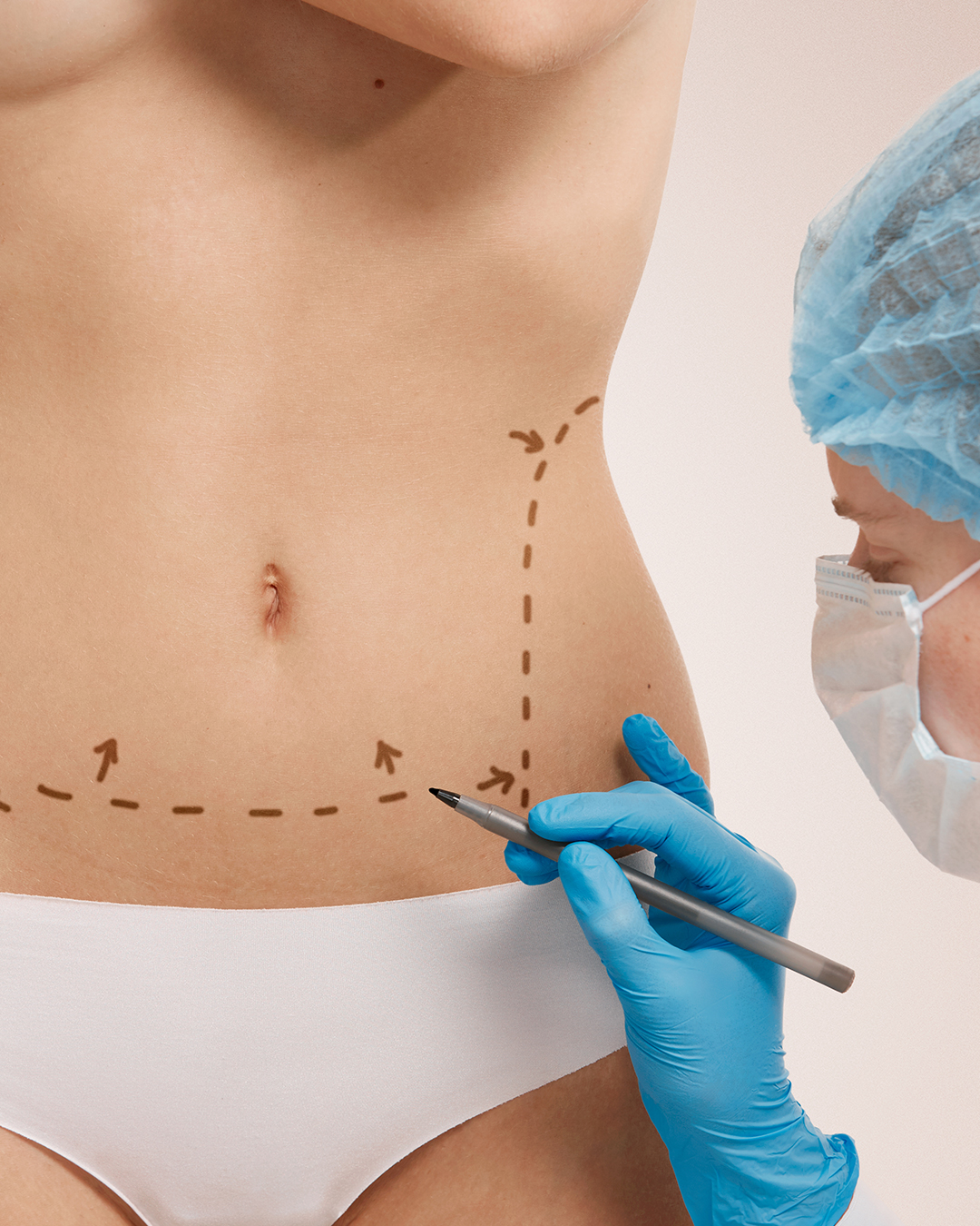 Chirurgien esthétique réalisant une procédure de liposuccion pour affiner la silhouette en Tunisie.