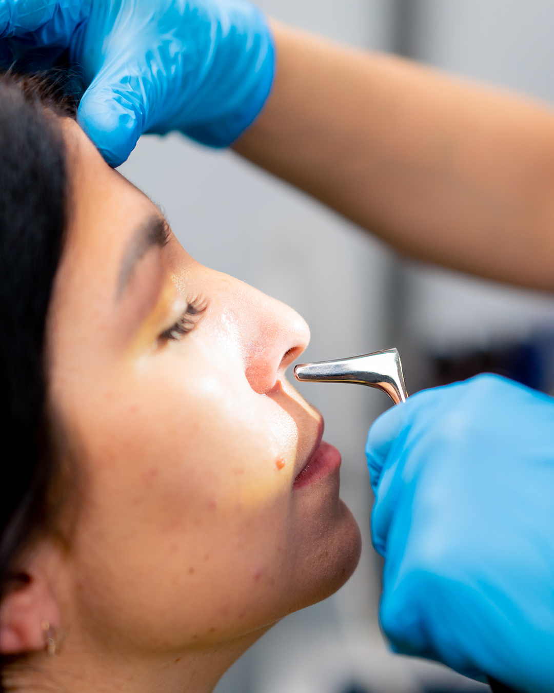 Chirurgie esthétique du nez en Tunisie pour corriger la forme, la taille ou la respiration avec Trivamed.